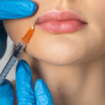 close up of a young woman receiving lip injections